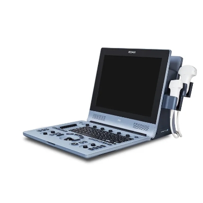 U60 Diagnostic Ultrasound System - Image 2