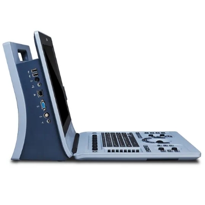 U60 Diagnostic Ultrasound System - Image 3